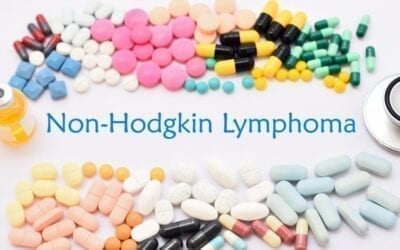 Non-Hodgkinov limfom NHL- Vodič za bolesnike
